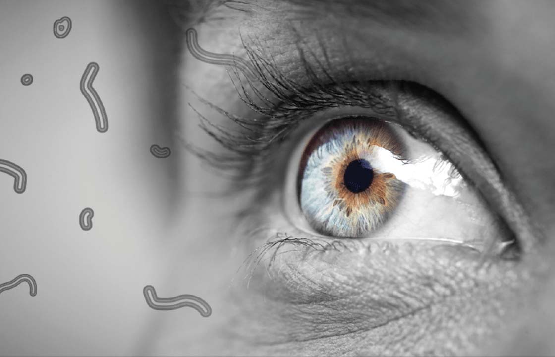 Eye floaters: what to notice and discuss
